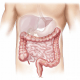 diverticules Consultations de Gastro-entérologie à la Polyclinique de Grande-Synthe