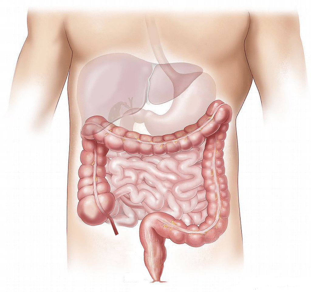 Diverticules : Qu'est-ce que c'est ? - Polyclinique Grande-Synthe